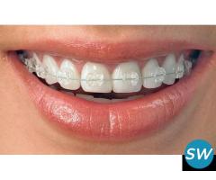 Orthodontic Treatment in Pimple Saudagar