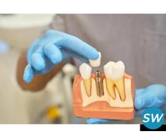 Best Dental Implant Clinic in Baner | Best Dental Implantology in Baner