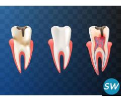 Root Canal Specialist in Pune | Root canal treatment in Pune - Kotadia's Dental care