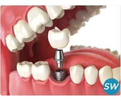 Best Dental Implant Clinic in Pimple Saudagar - 1
