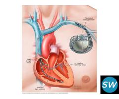 Pacemaker Implant in Pune | Pacemaker Cost in Pune - Dr. Rahul Sawant