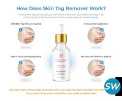 Amarose Skin Tag Remover - Amarose Skin Tag Remover Official Website