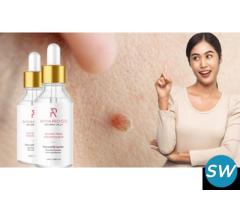 Amarose Skin Tag Remover, Incidental effects, Medical advantages, Masters and Cons