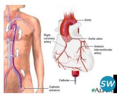 Angiography in Pune