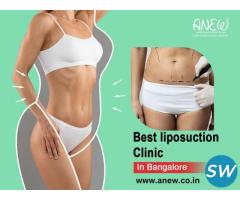 Best liposuction Clinic in Bangalore – Anew - 1