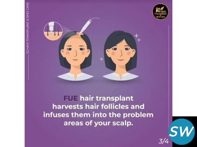 hair transplant cost in chennai - 1