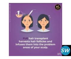 hair transplant cost in chennai