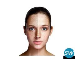 Skin Pigmentation Treatment