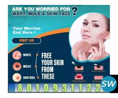 Who is the best doctor for skin treatment in Delhi? - 1