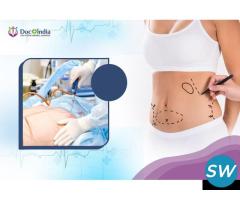 Liposuction Surgery Cost In Hyderabad at Docplusin - 1