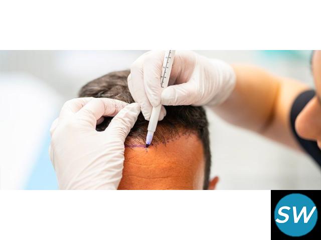 Cost-effective Hair transplant cost in Jaipur - 1