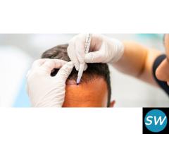 Cost-effective Hair transplant cost in Jaipur - 1