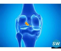 Affordable ACL Ligament Surgery In Dubai - 1
