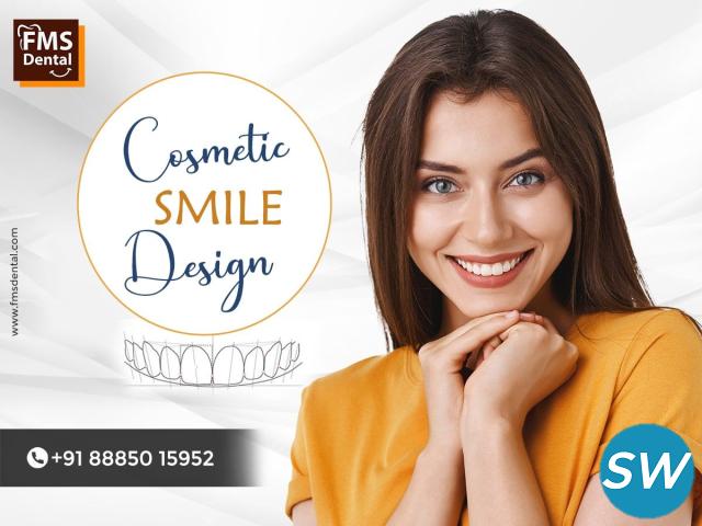Smile Enhancement clinic in jubilee hills at hyd - 1