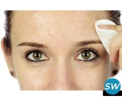 Oily skin treatment at fms skin and hair - 1
