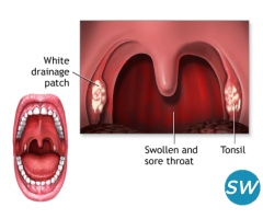 Find Relief for Your Throat: Top Throat Specialist - 1