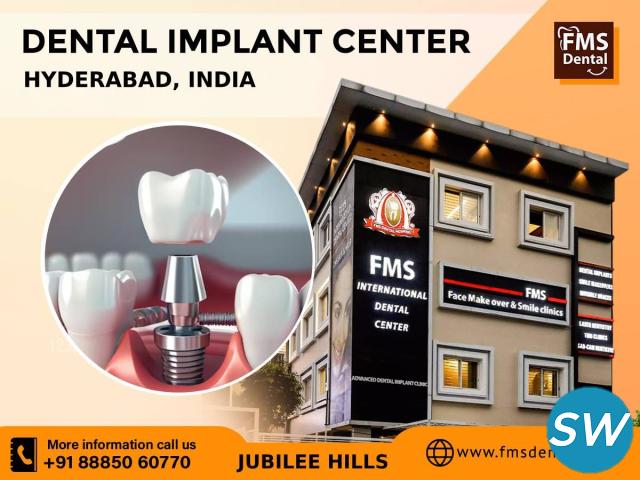 Dental Implants for a Beautiful Smile at FMS - 1
