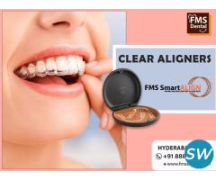 FMS Dental Clear Aligners For a Radiant Smile - 2