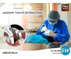 Best Dental Clinic in Jubilee Hills Hyderabad
