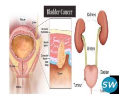 Bladder Cancer Specialist/Surgeon in Navi Mumbai - 1