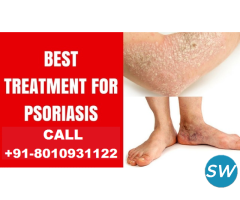 Best treatment for psoriasis in Mukherjee Nagar - 1