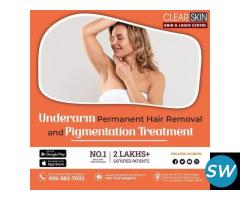Laser treatment clinic in india