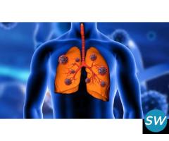 Lung Cancer Specialist in Ahmedabad