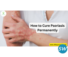 How to Cure Psoriasis Permanently - 2