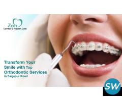 Best Orthodontic Treatment in Sarjapur Road